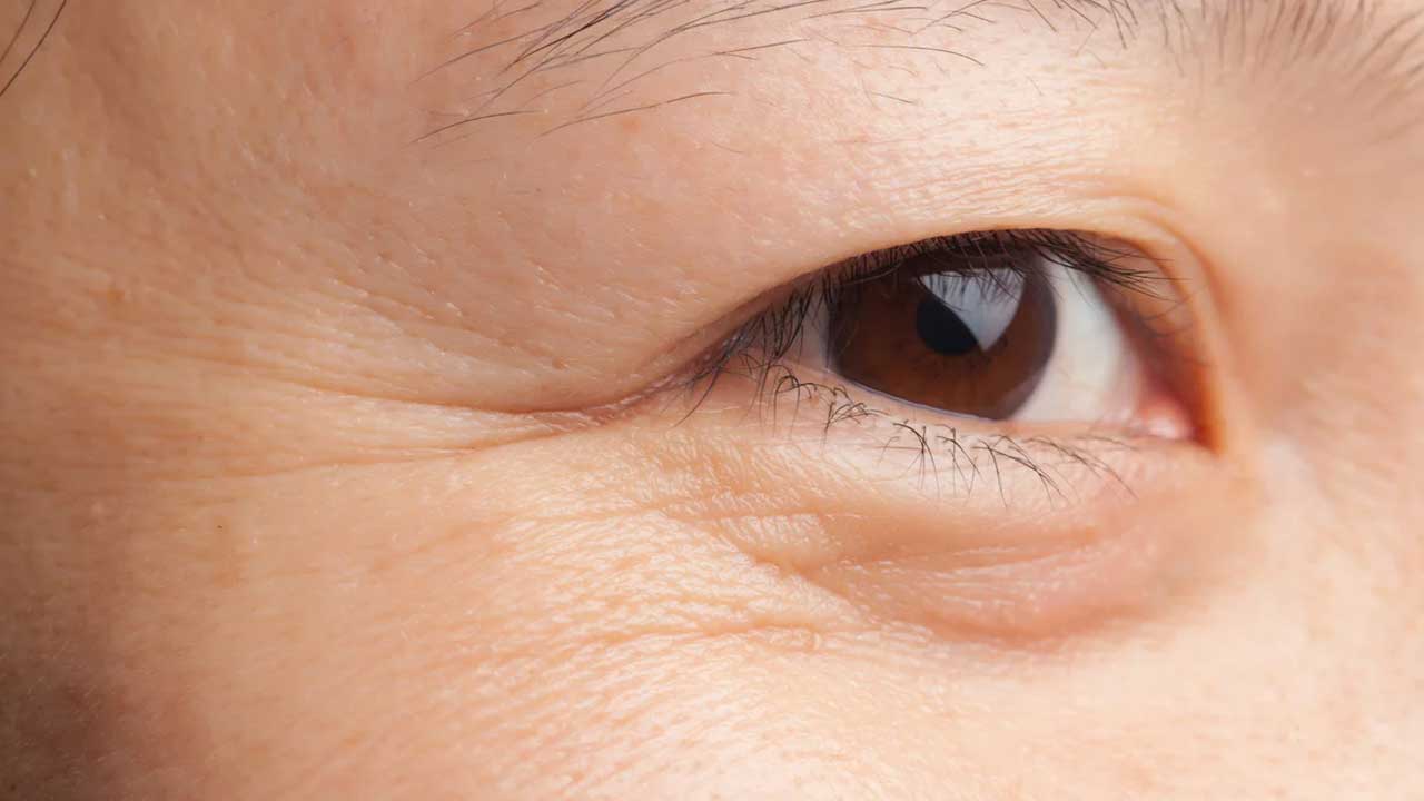 Wrinkle and Aging