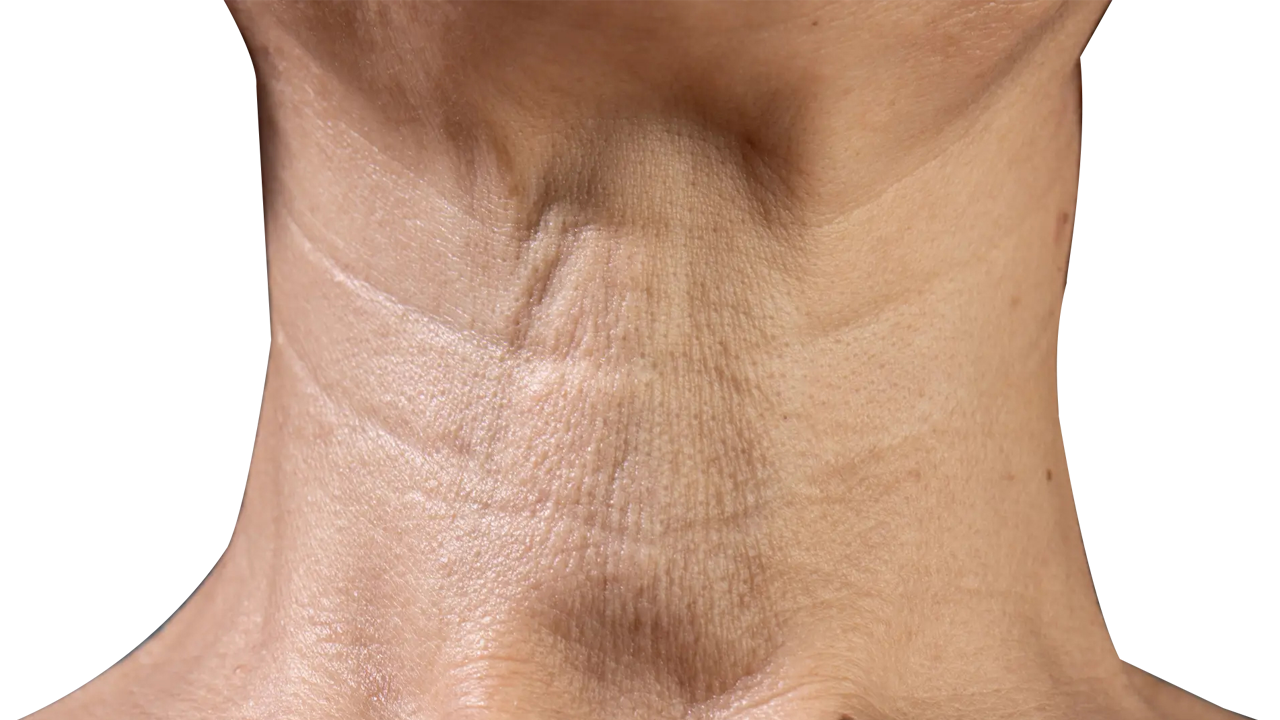 Wrinkle and Aging