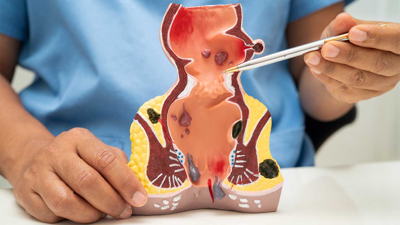 Prostatitis