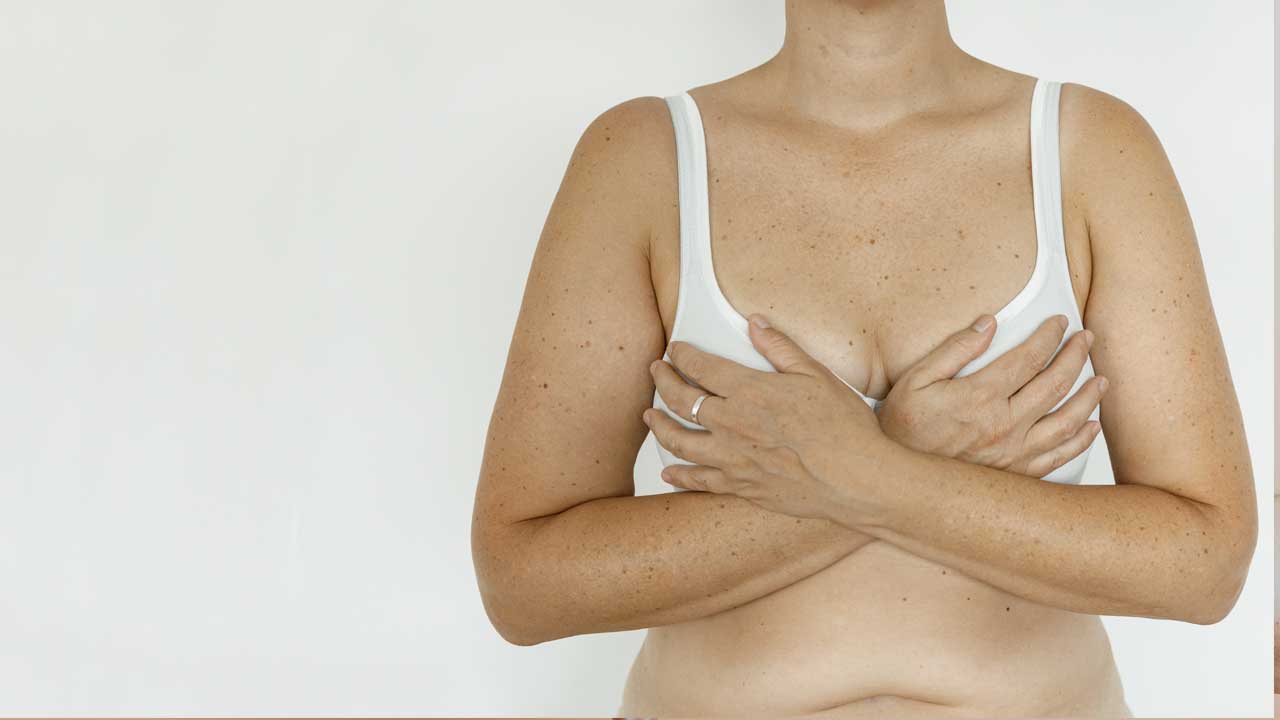 Sagging Breast